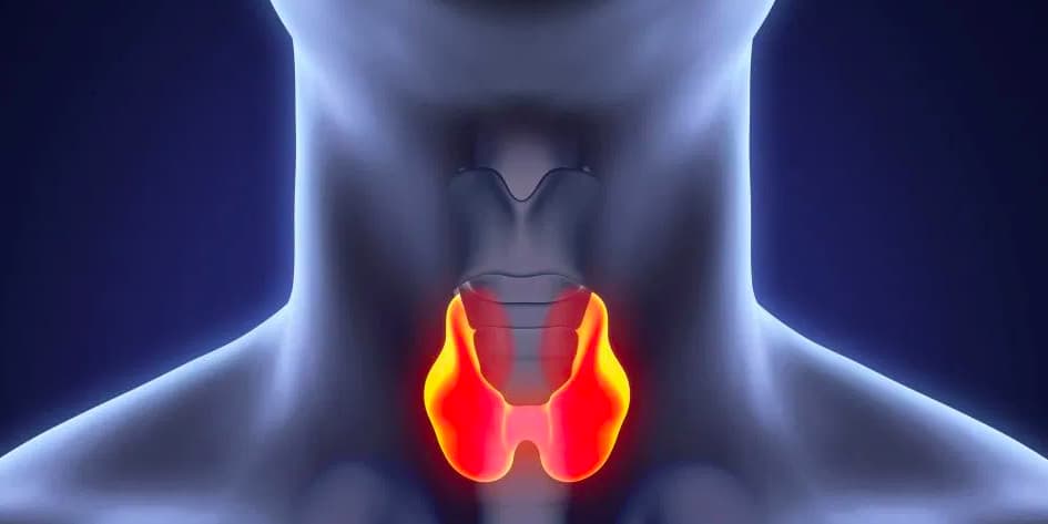 Симптомы, причины, диагностика и лечение рака щитовидной железы